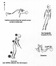 Exemples de positions d'inhumations dans les tumulus funéraires sénégambiens Position courante dans les tumulus sereer actuels et subactuels; Rao-Nguiguéla (tumulus E et G); Soukouta (les chiffres indiquent des céramiques); Dionewar