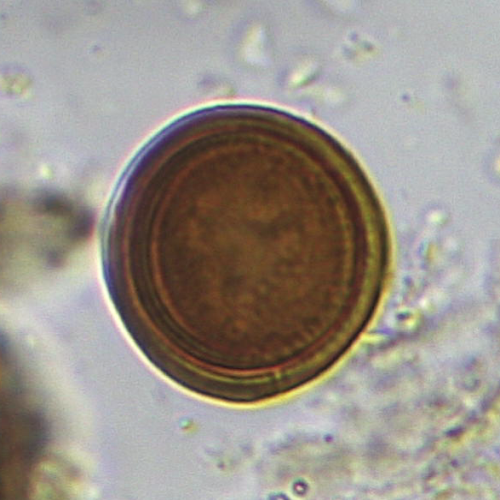 a microscopic snapshot of a Cestode egg