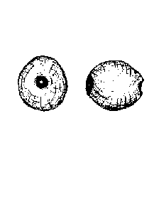 fig1e - bead